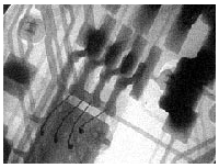 Surface mounted IC permits inspection of the wires within the IC and the solder joint quality of the leads, revealing insufficient solder on the right-most lead. 