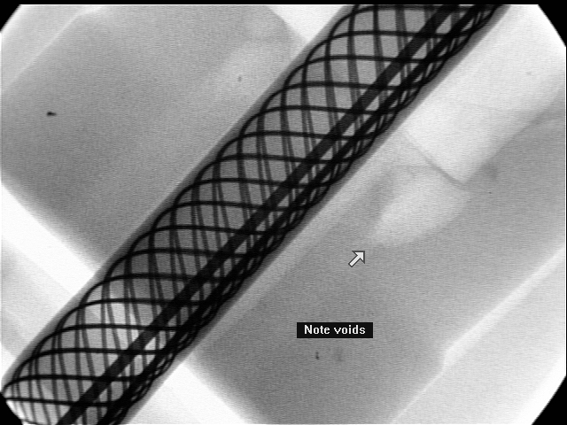 Steerable Sheath Handle Voids